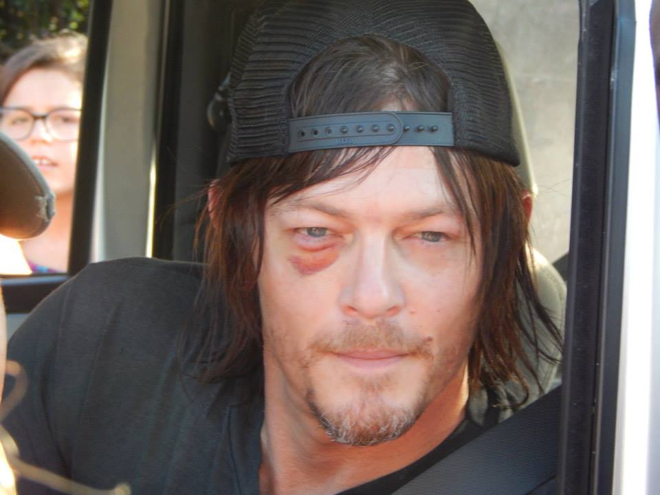 black eye norman